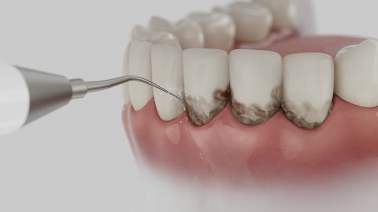 Reliable Dental Implants contractor in Taylor, PA by Smile Center Dentistry